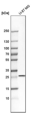 RAB27B Antibody in Western Blot (WB)