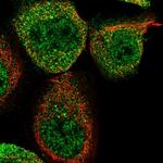 WIPI2 Antibody in Immunocytochemistry (ICC/IF)