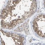 WIPI2 Antibody in Immunohistochemistry (IHC)