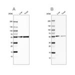 GC Antibody in Western Blot (WB)