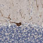 RINT1 Antibody in Immunohistochemistry (Paraffin) (IHC (P))