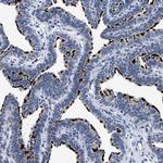 RINT1 Antibody in Immunohistochemistry (Paraffin) (IHC (P))