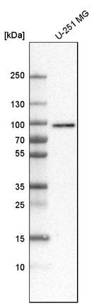 RINT1 Antibody in Western Blot (WB)