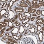 PPA1 Antibody in Immunohistochemistry (Paraffin) (IHC (P))