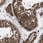 PPA1 Antibody in Immunohistochemistry (Paraffin) (IHC (P))