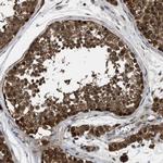 PPA1 Antibody in Immunohistochemistry (IHC)