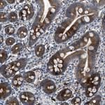 URG4 Antibody in Immunohistochemistry (Paraffin) (IHC (P))