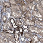 URG4 Antibody in Immunohistochemistry (Paraffin) (IHC (P))