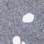 URG4 Antibody in Immunohistochemistry (Paraffin) (IHC (P))