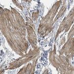 URG4 Antibody in Immunohistochemistry (IHC)