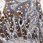 IL17RC Antibody in Immunohistochemistry (IHC)