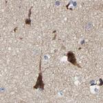 CCDC155 Antibody in Immunohistochemistry (IHC)