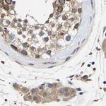 CCDC155 Antibody in Immunohistochemistry (IHC)