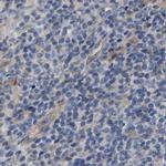 CCDC155 Antibody in Immunohistochemistry (IHC)