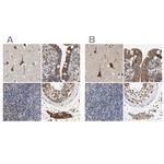 CCDC155 Antibody in Immunohistochemistry (IHC)