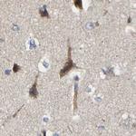 CCDC155 Antibody in Immunohistochemistry (IHC)