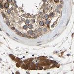 CCDC155 Antibody in Immunohistochemistry (IHC)