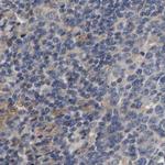 CCDC155 Antibody in Immunohistochemistry (IHC)