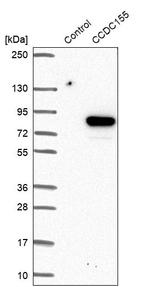 CCDC155 Antibody in Western Blot (WB)