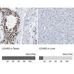 DBC1 Antibody in Immunohistochemistry (IHC)