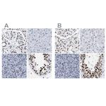 DBC1 Antibody in Immunohistochemistry (IHC)