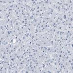 DBC1 Antibody in Immunohistochemistry (IHC)