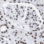 DBC1 Antibody in Immunohistochemistry (IHC)