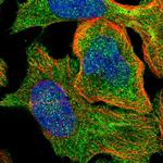 SSH3 Antibody in Immunocytochemistry (ICC/IF)