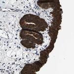 SSH3 Antibody in Immunohistochemistry (Paraffin) (IHC (P))