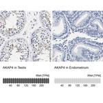 AKAP4 Antibody in Immunohistochemistry (IHC)