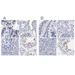 AKAP4 Antibody in Immunohistochemistry (IHC)