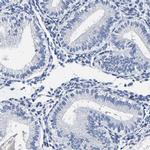 AKAP4 Antibody in Immunohistochemistry (IHC)