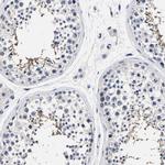 AKAP4 Antibody in Immunohistochemistry (IHC)