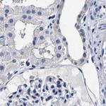 AKAP4 Antibody in Immunohistochemistry (IHC)