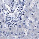 AKAP4 Antibody in Immunohistochemistry (IHC)