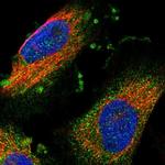 IFT81 Antibody in Immunocytochemistry (ICC/IF)