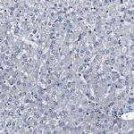 IFT81 Antibody in Immunohistochemistry (IHC)