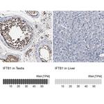 IFT81 Antibody