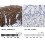 TRIM29 Antibody in Immunohistochemistry (IHC)