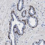 TRIM29 Antibody in Immunohistochemistry (IHC)