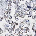 TRIM29 Antibody in Immunohistochemistry (IHC)