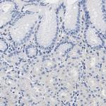 TRIM29 Antibody in Immunohistochemistry (IHC)