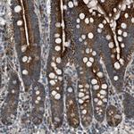 VPS41 Antibody in Immunohistochemistry (IHC)