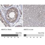 ABCF2 Antibody in Immunohistochemistry (IHC)