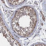 ABCF2 Antibody in Immunohistochemistry (IHC)