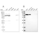 ABCF2 Antibody in Western Blot (WB)