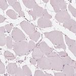 PAEP Antibody in Immunohistochemistry (IHC)