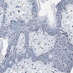 CaV1.3 Antibody in Immunohistochemistry (Paraffin) (IHC (P))