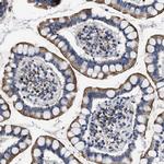 CaV1.3 Antibody in Immunohistochemistry (Paraffin) (IHC (P))