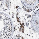 CaV1.3 Antibody in Immunohistochemistry (Paraffin) (IHC (P))